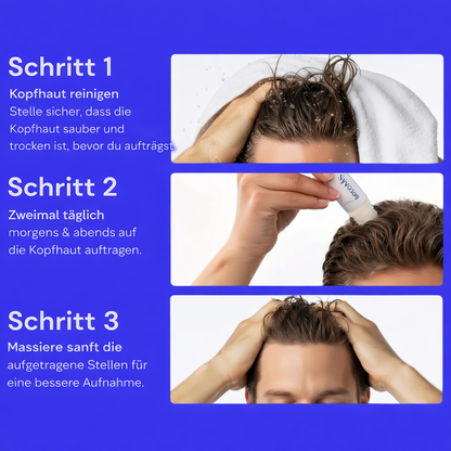 Sylviona - Haar Wachstum Roll On